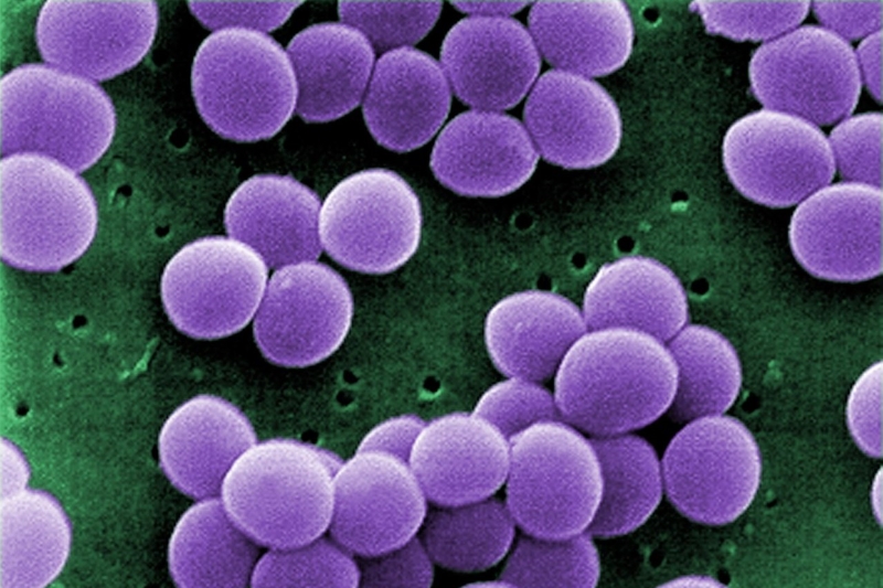 antimicrobial resistance
